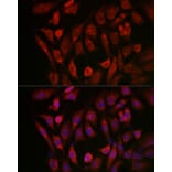 Immunofluorescence - Anti-Cathepsin B Antibody (A12726) - Antibodies.com