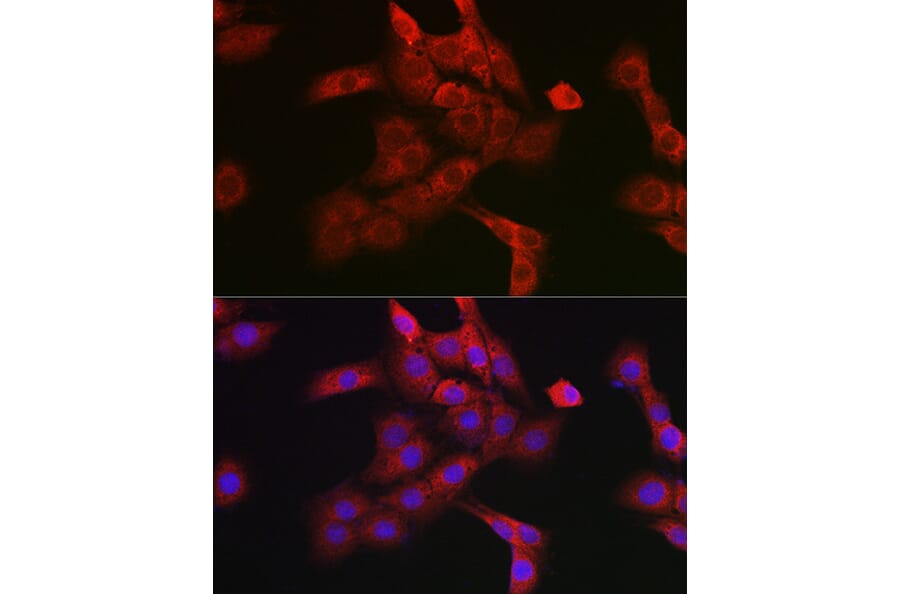 Immunofluorescence - Anti-Cathepsin B Antibody (A12726) - Antibodies.com