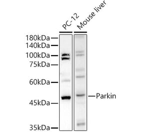 Western Blot - Anti-Parkin Antibody (A12727) - Antibodies.com