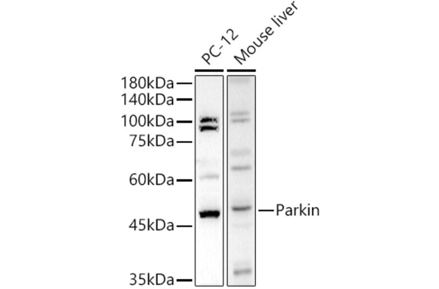 Western Blot - Anti-Parkin Antibody (A12727) - Antibodies.com
