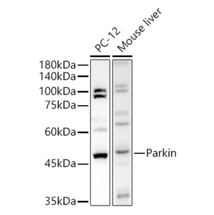 Western Blot - Anti-Parkin Antibody (A12727) - Antibodies.com