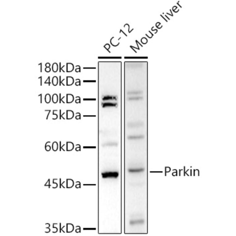 Western Blot - Anti-Parkin Antibody (A12727) - Antibodies.com