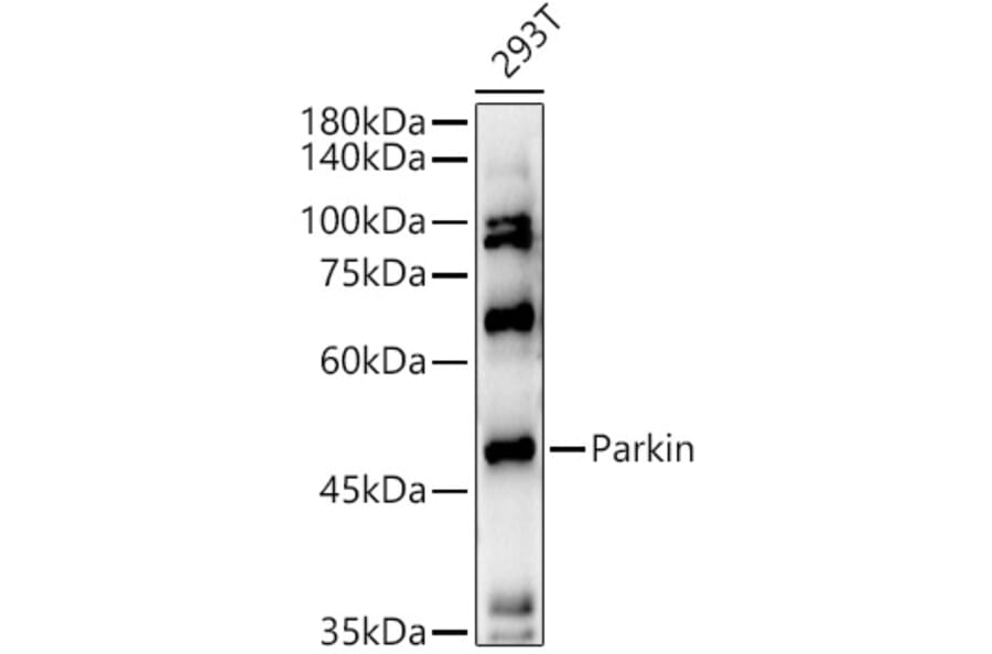 Western Blot - Anti-Parkin Antibody (A12727) - Antibodies.com
