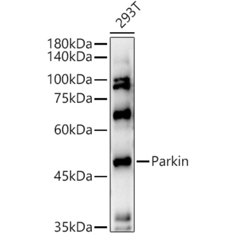 Western Blot - Anti-Parkin Antibody (A12727) - Antibodies.com