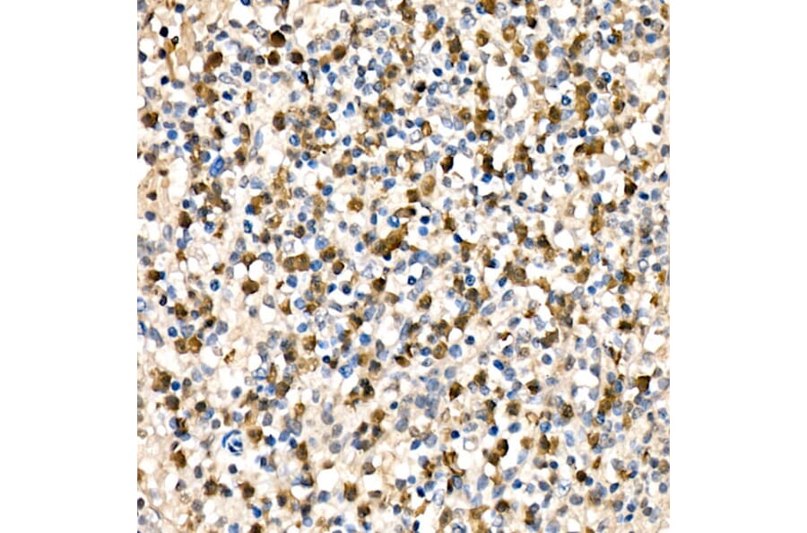 Immunohistochemistry - Anti-Parkin Antibody (A12727) - Antibodies.com