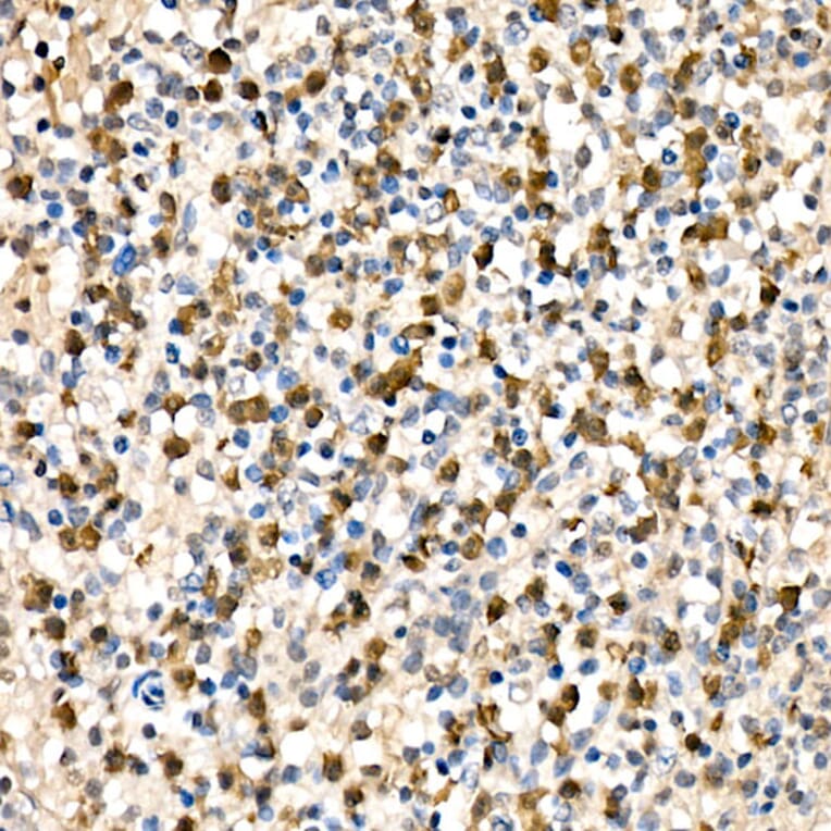 Immunohistochemistry - Anti-Parkin Antibody (A12727) - Antibodies.com