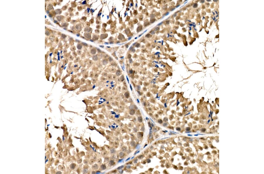 Immunohistochemistry - Anti-Parkin Antibody (A12727) - Antibodies.com
