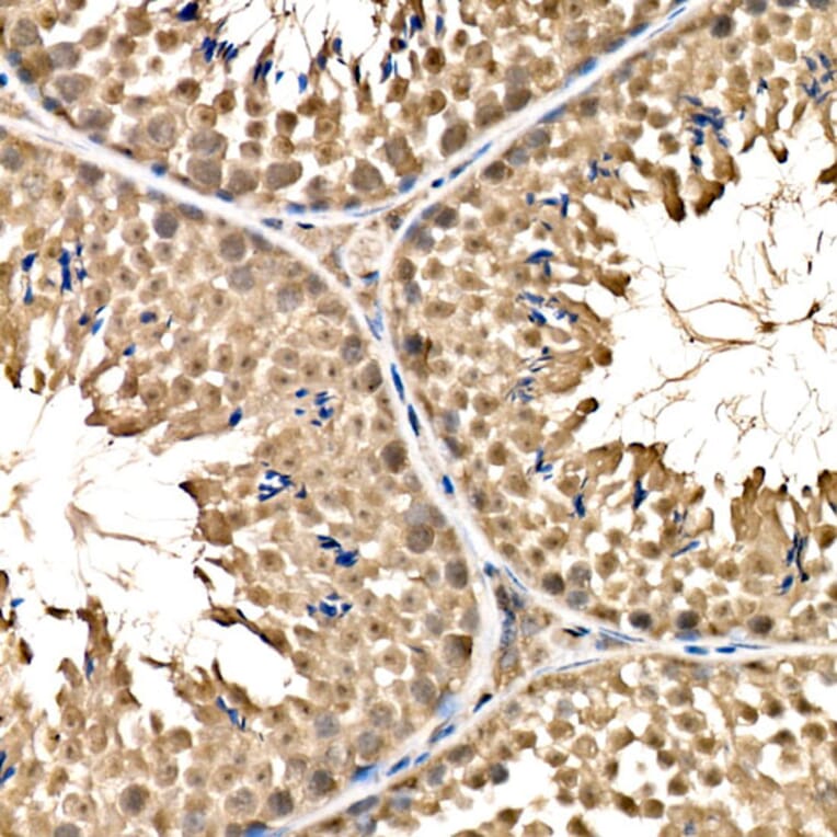 Immunohistochemistry - Anti-Parkin Antibody (A12727) - Antibodies.com