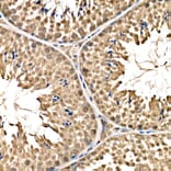 Immunohistochemistry - Anti-Parkin Antibody (A12727) - Antibodies.com
