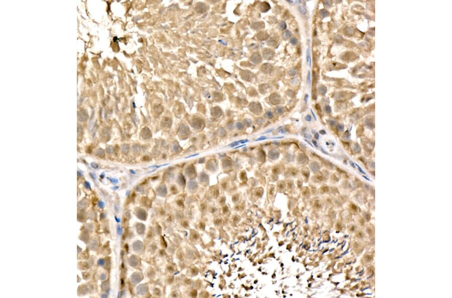 Immunohistochemistry - Anti-Parkin Antibody (A12727) - Antibodies.com