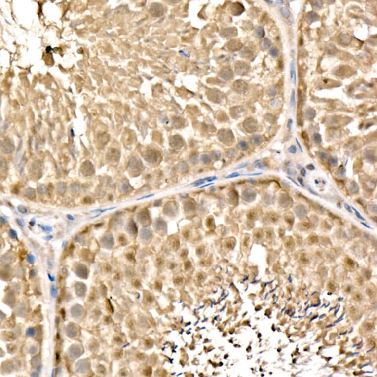 Immunohistochemistry - Anti-Parkin Antibody (A12727) - Antibodies.com