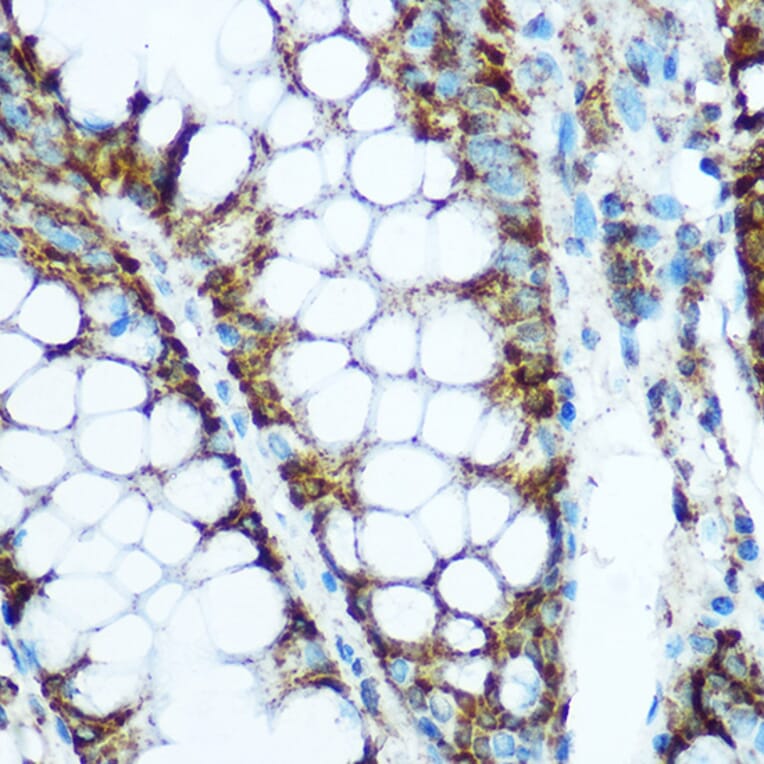 Immunohistochemistry - Anti-HSP60 Antibody (A12728) - Antibodies.com