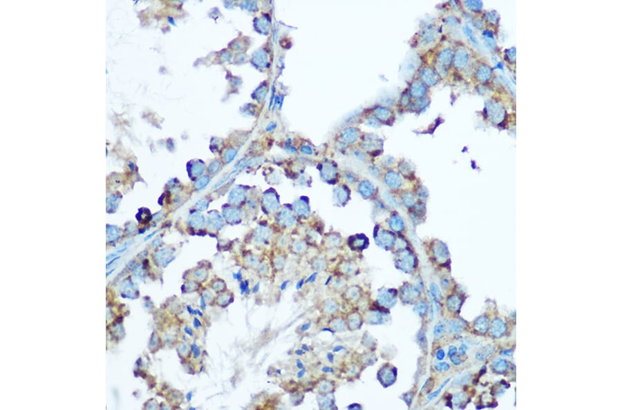 Immunohistochemistry - Anti-HSP60 Antibody (A12728) - Antibodies.com
