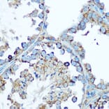 Immunohistochemistry - Anti-HSP60 Antibody (A12728) - Antibodies.com