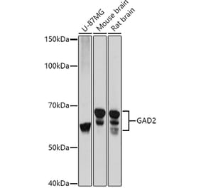 Western Blot - Anti-GAD65 Antibody (A12729) - Antibodies.com