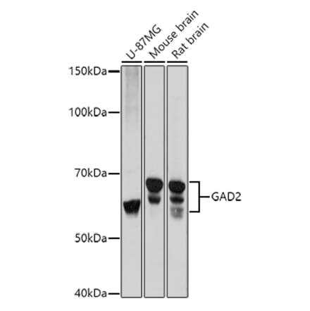 Western Blot - Anti-GAD65 Antibody (A12729) - Antibodies.com