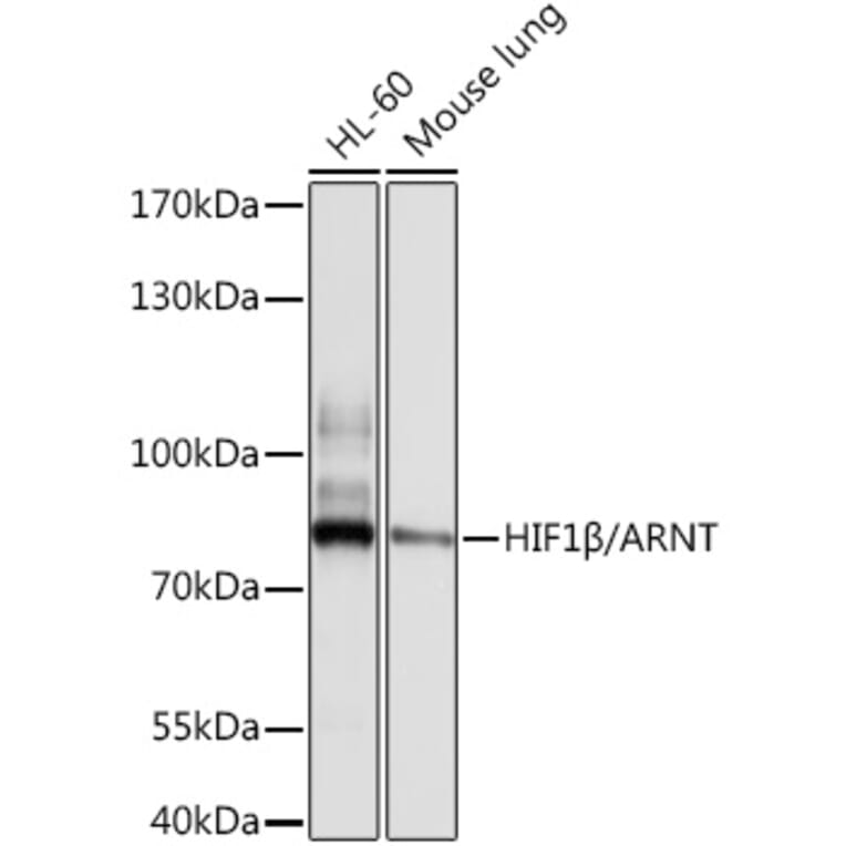 Western Blot - Anti-HIF1 beta Antibody (A12730) - Antibodies.com