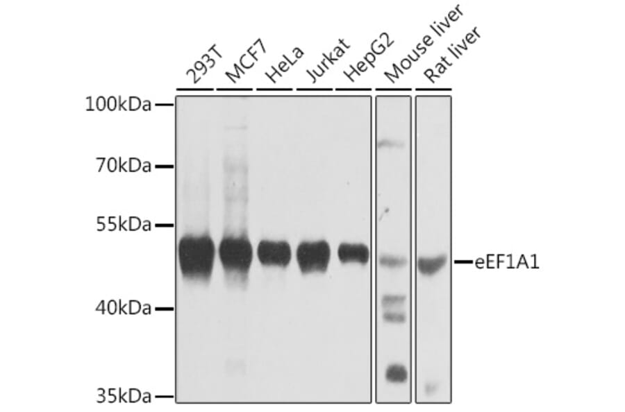 Western Blot - Anti-eEF1A1/EF-Tu Antibody (A12732) - Antibodies.com