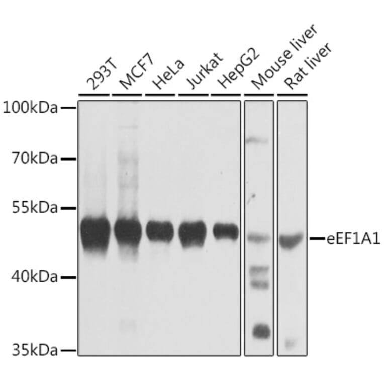 Western Blot - Anti-eEF1A1/EF-Tu Antibody (A12732) - Antibodies.com