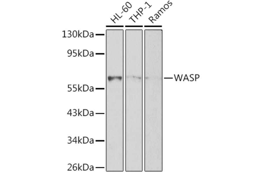 Western Blot - Anti-WASP/Wiskott-Aldrich syndrome protein Antibody (A12736) - Antibodies.com