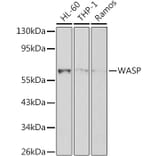 Western Blot - Anti-WASP/Wiskott-Aldrich syndrome protein Antibody (A12736) - Antibodies.com