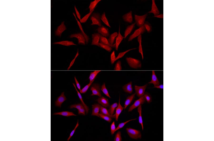 Immunofluorescence - Anti-MyD88 Antibody (A12738) - Antibodies.com