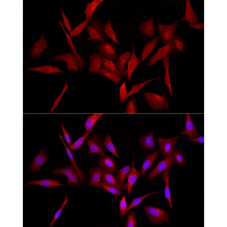 Immunofluorescence - Anti-MyD88 Antibody (A12738) - Antibodies.com