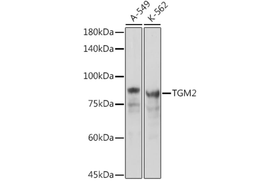 Western Blot - Anti-Transglutaminase 2 Antibody (A12739) - Antibodies.com