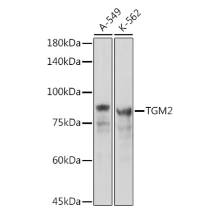 Western Blot - Anti-Transglutaminase 2 Antibody (A12739) - Antibodies.com