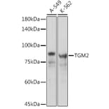 Western Blot - Anti-Transglutaminase 2 Antibody (A12739) - Antibodies.com