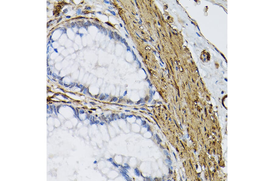 Immunohistochemistry - Anti-Transglutaminase 2 Antibody (A12739) - Antibodies.com