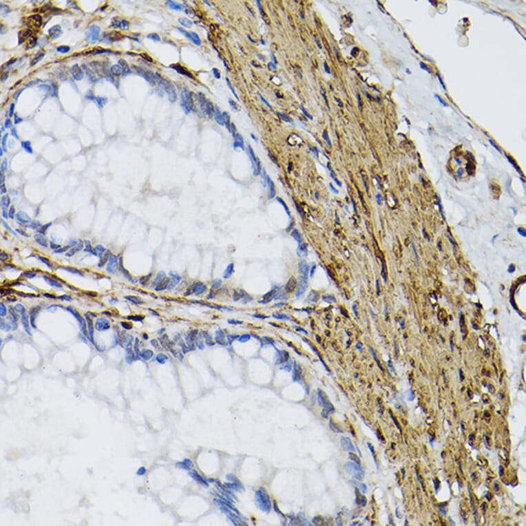 Immunohistochemistry - Anti-Transglutaminase 2 Antibody (A12739) - Antibodies.com