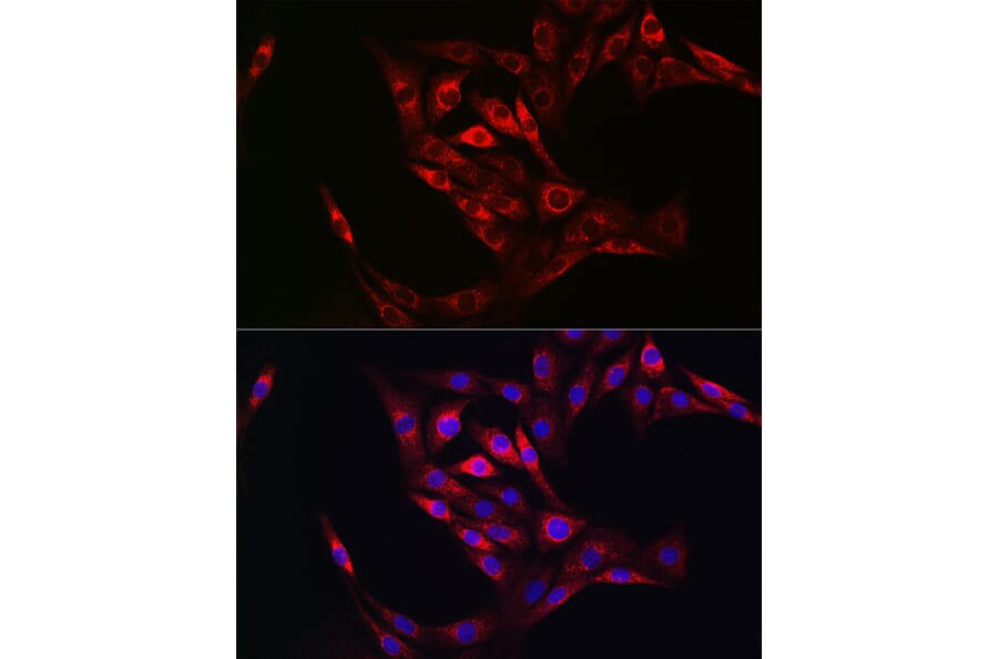 Immunofluorescence - Anti-Transglutaminase 2 Antibody (A12739) - Antibodies.com