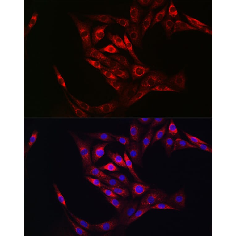 Immunofluorescence - Anti-Transglutaminase 2 Antibody (A12739) - Antibodies.com