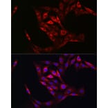 Immunofluorescence - Anti-Transglutaminase 2 Antibody (A12739) - Antibodies.com