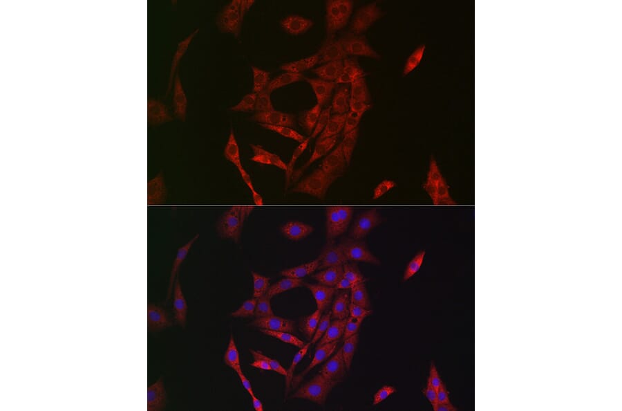 Immunofluorescence - Anti-Transglutaminase 2 Antibody (A12739) - Antibodies.com