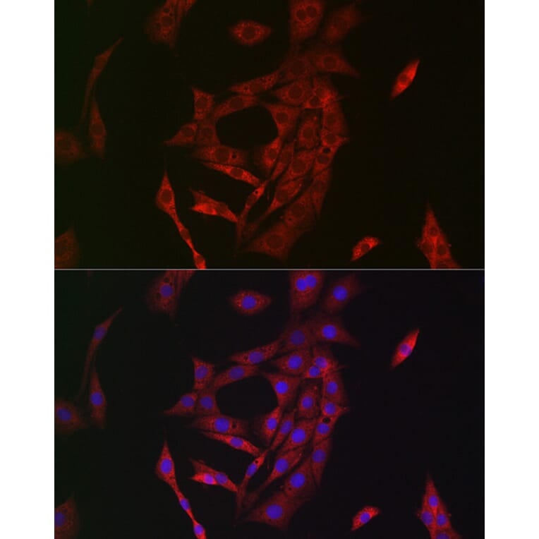 Immunofluorescence - Anti-Transglutaminase 2 Antibody (A12739) - Antibodies.com