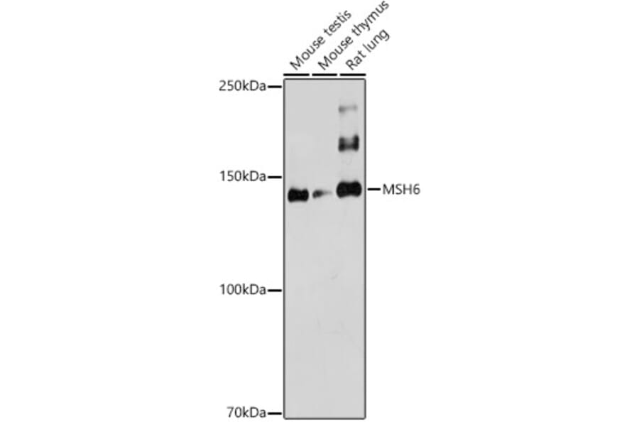 Western Blot - Anti-MSH6 Antibody (A12741) - Antibodies.com