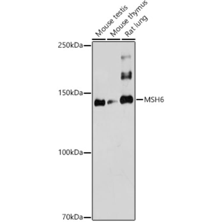 Western Blot - Anti-MSH6 Antibody (A12741) - Antibodies.com