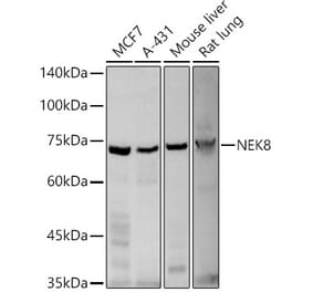 Western Blot - Anti-NEK8 Antibody (A12742) - Antibodies.com