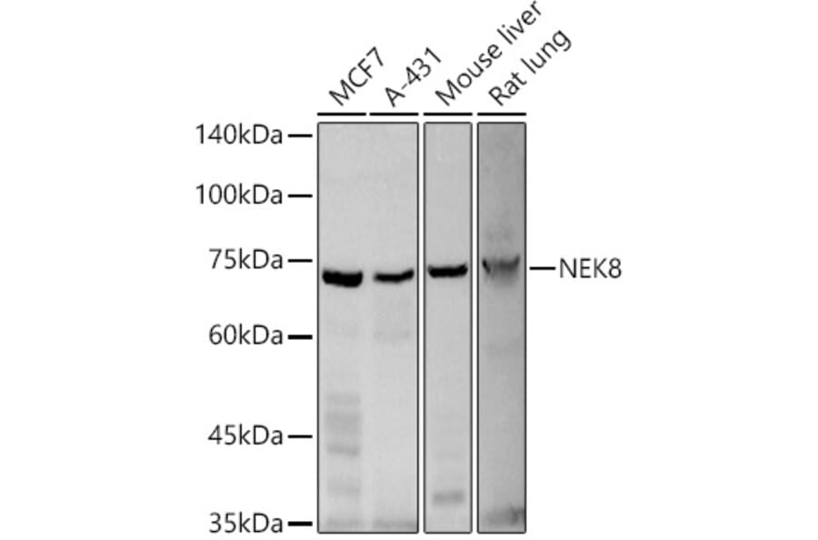 Western Blot - Anti-NEK8 Antibody (A12742) - Antibodies.com
