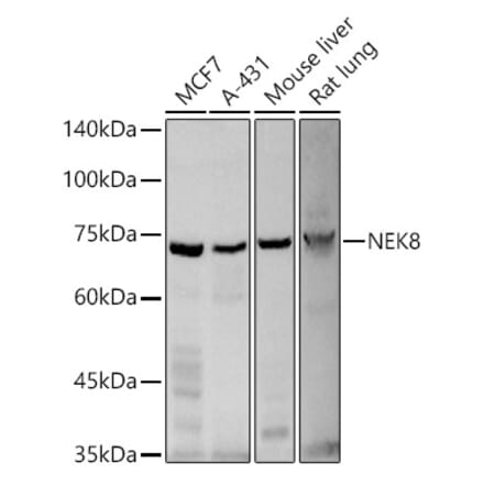 Western Blot - Anti-NEK8 Antibody (A12742) - Antibodies.com