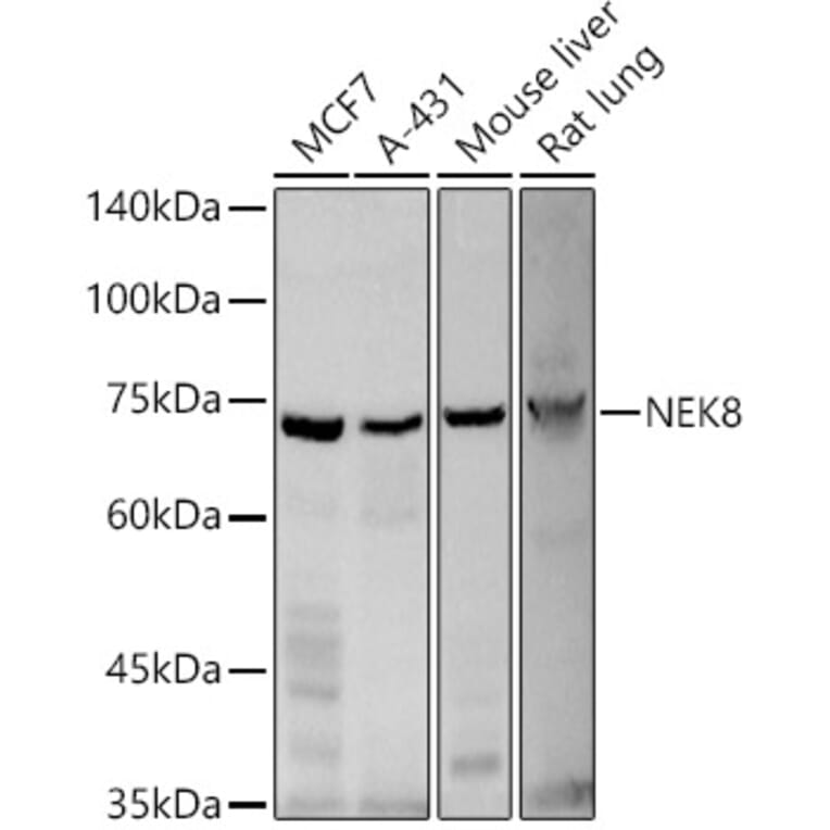 Western Blot - Anti-NEK8 Antibody (A12742) - Antibodies.com