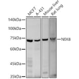 Western Blot - Anti-NEK8 Antibody (A12742) - Antibodies.com