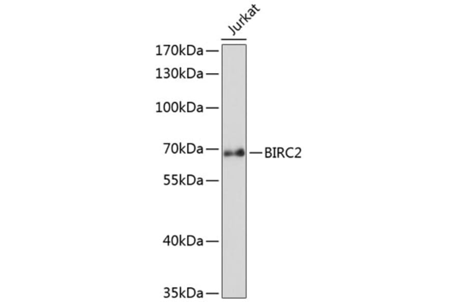 Western Blot - Anti-BIRC2 Antibody (A0985) - Antibodies.com