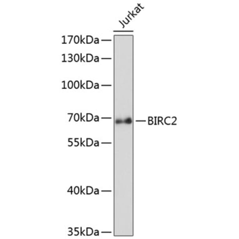 Western Blot - Anti-BIRC2 Antibody (A0985) - Antibodies.com