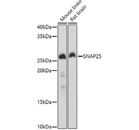 Western Blot - Anti-SNAP25 Antibody (A12744) - Antibodies.com