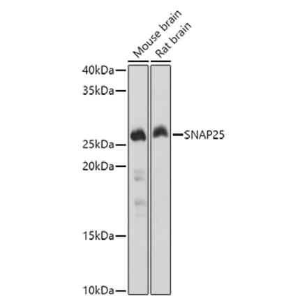 Western Blot - Anti-SNAP25 Antibody (A12744) - Antibodies.com