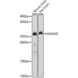 Western Blot - Anti-SNAP25 Antibody (A12744) - Antibodies.com