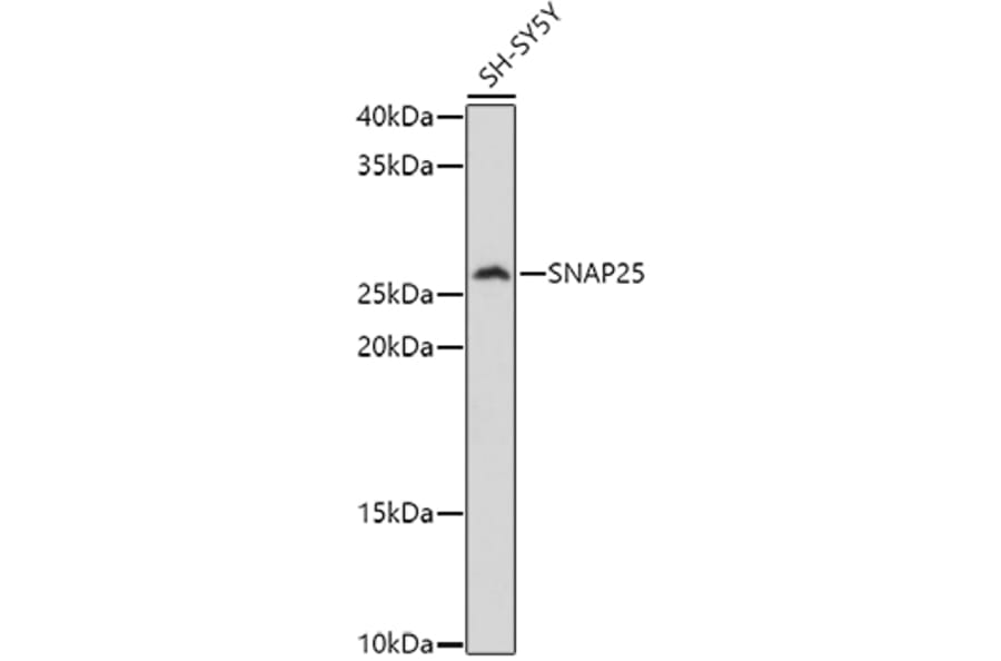 Western Blot - Anti-SNAP25 Antibody (A12744) - Antibodies.com